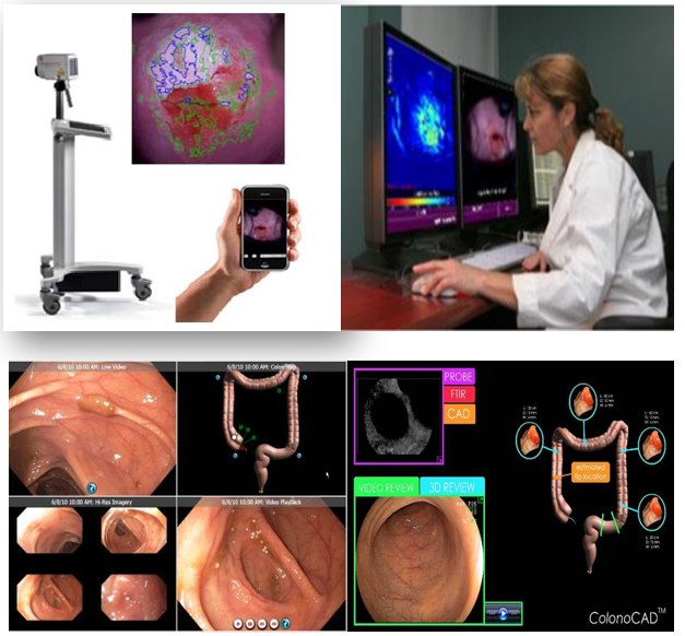 STI Medical Systems - ColonoCAD Colon Cancer Screening Technology